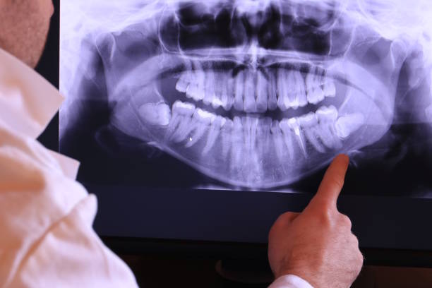 Best Broken Tooth Emergency  in Lus Valley Marinwood, CA