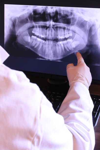 Best Emergency Tooth Extraction  in Lus Valley Marinwood, CA
