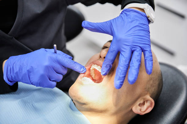 Best Dental Emergency Near Me  in Lus Valley Marinwood, CA